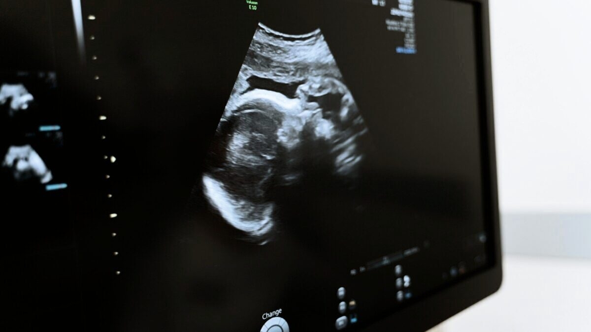 découvrez les meilleurs échographes de poche disponibles dans le tarn, alliant compacité et performance. idéaux pour les professionnels de la santé en quête de précision et de praticité lors de leurs examens médicaux.